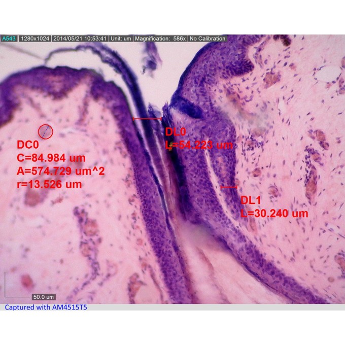 Microscop USB cu marire 500X si citire automata a nivelului de marire AM4515T5